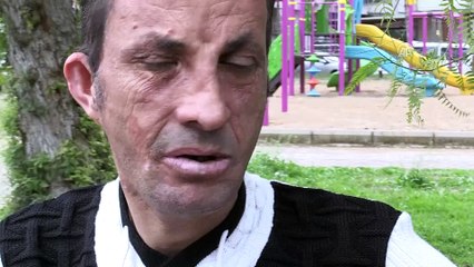 Yüz nakliyle 6 yıldır yüzü gülüyor - ANTALYA