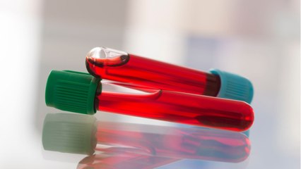Un test sanguin pour prévenir du cancer avant les premiers symptômes