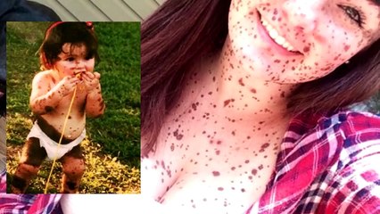 10 People with Unique Skin - Top List