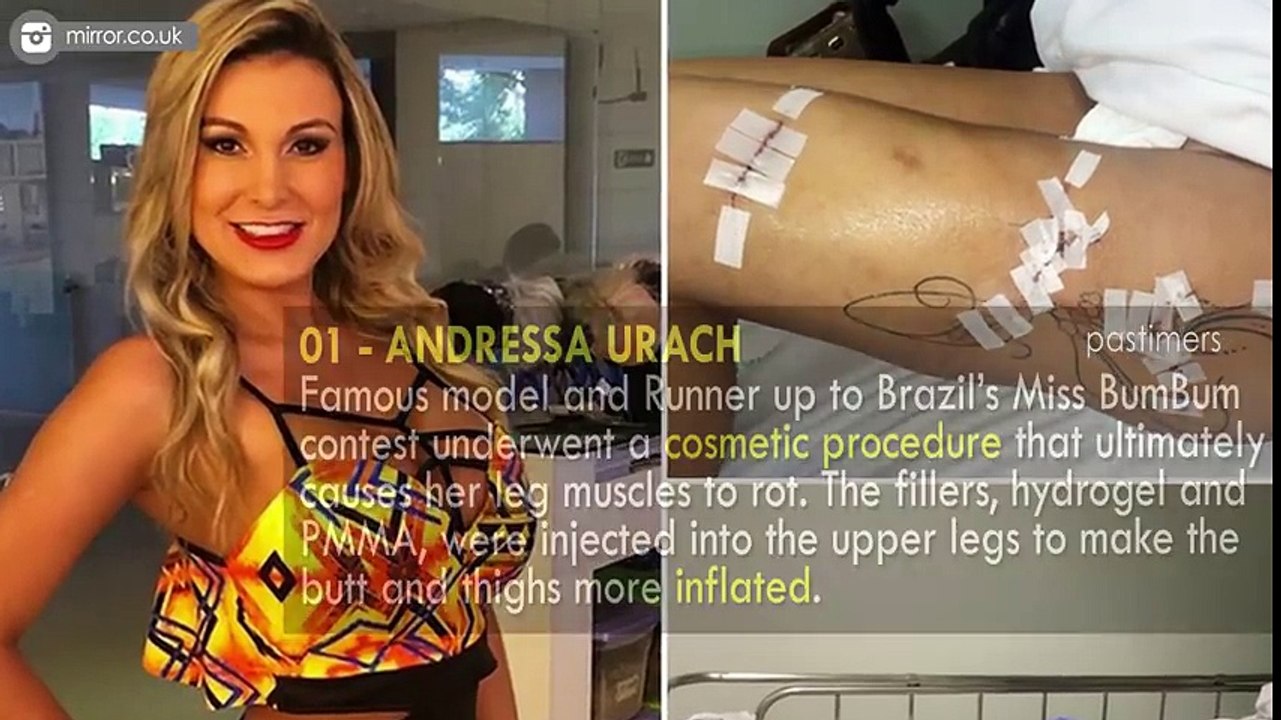 10 Surgery Operations Gone Terribly Wrong