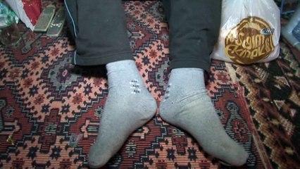 Görmek için 17 yıl beklediği güneşe akülü arabası olmadığı için çıkamıyor