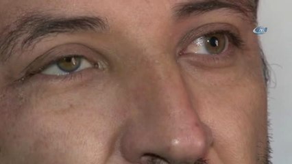 Görmek İçin 17 Yıl Beklediği Güneşe Akülü Arabası Olmadığı İçin Çıkamıyor