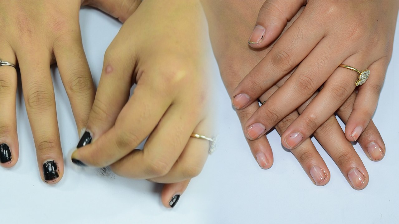 Remove Nail Polish WITHOUT Nail Polish Remover | DIY | Boldsky