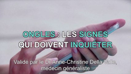 Ongles : 3 signes d'alerte