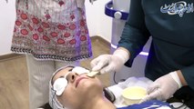چہرے پر موجود غیر ضروری بالوں کا بذریعہ لیزر ٹریٹمنٹ علاج ، دیکھیے شمائلہ بیوٹی لندن میں لیزر ٹریٹمنٹ کا طریقہ کار اور اس سروس سے متعلق سوالوں کے جواب سجل بشیر