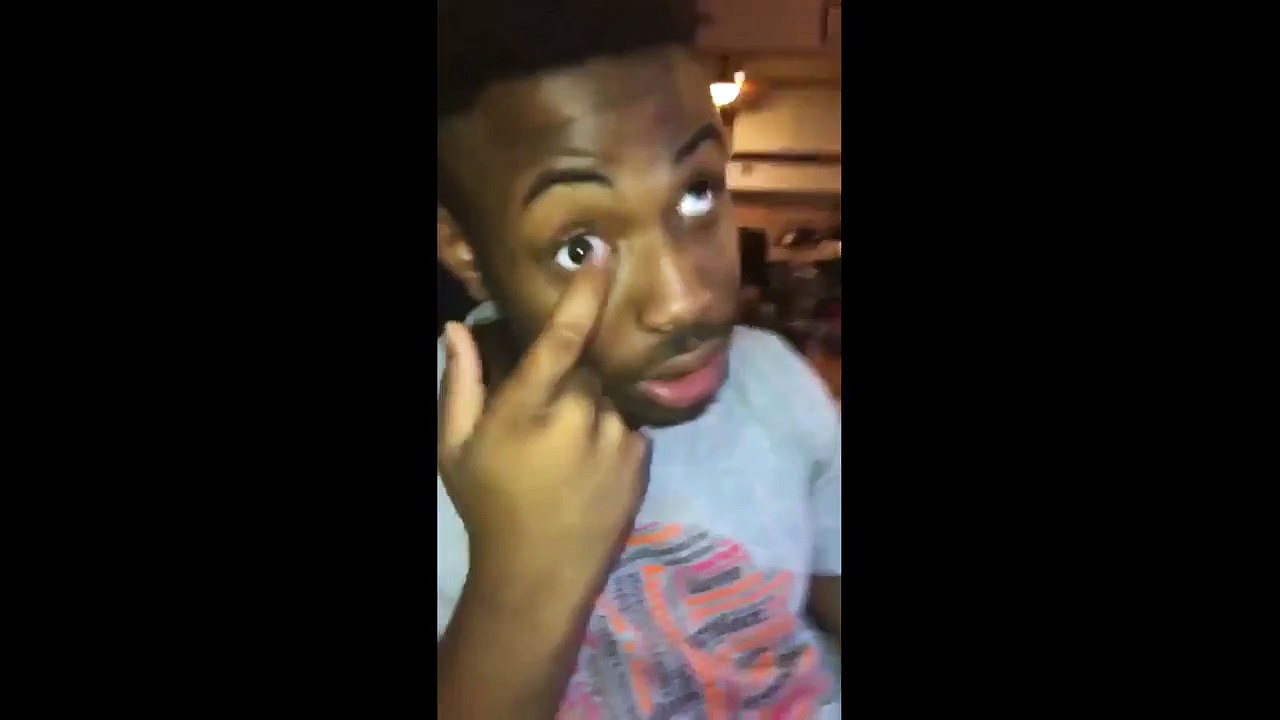 DON'T ROLL YOUR EYES AT ME! - Prosthetic eye pops out (Prank)