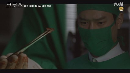 간에 박힌 '유리 조각' 맨눈으로 찾아낸 고경표!