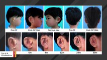 Scientists In China Use Five Children’s Cells To Grow Them Replacement Ears
