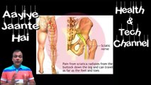 Sciatica pain %26 home remedies %7C Sciatica pain ka Gharelu Upchar%7CSciatica nervepain%7CSciatica Exercise