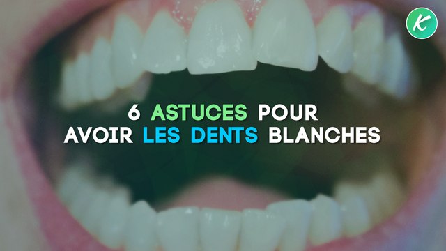 6 astuces pour avoir les dents blanches !