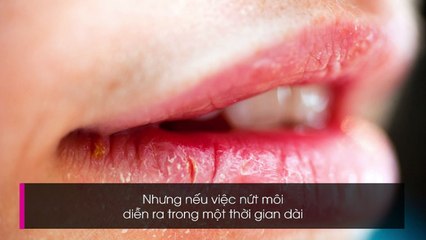 Bật mí cách nhìn môi đoán bệnh cực chuẩn