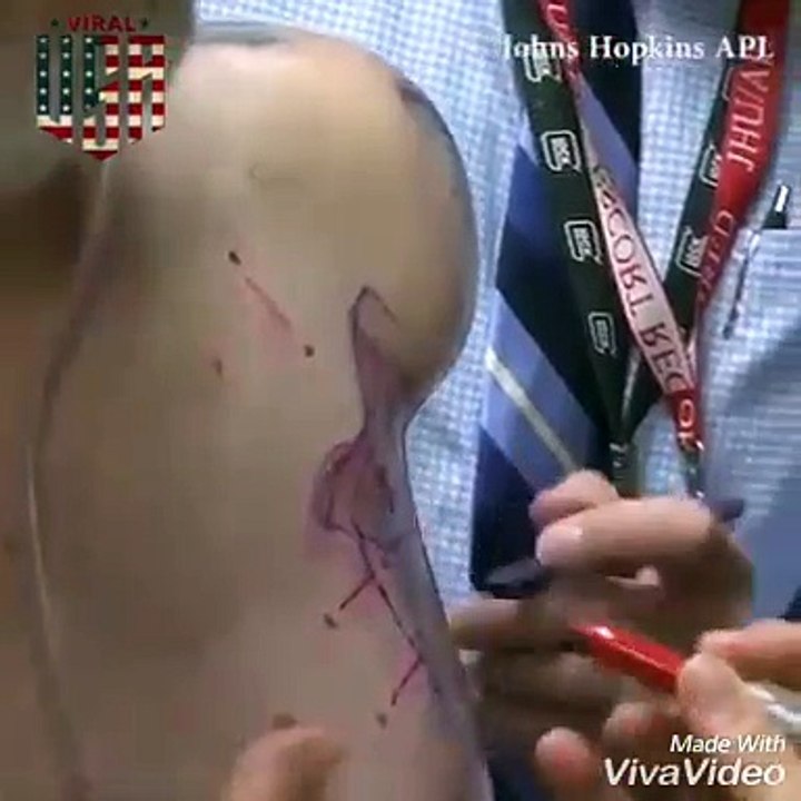 New technology