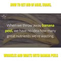 How to Get Rid of Acne, Scars, Wrinkles and Warts with Banana Peels