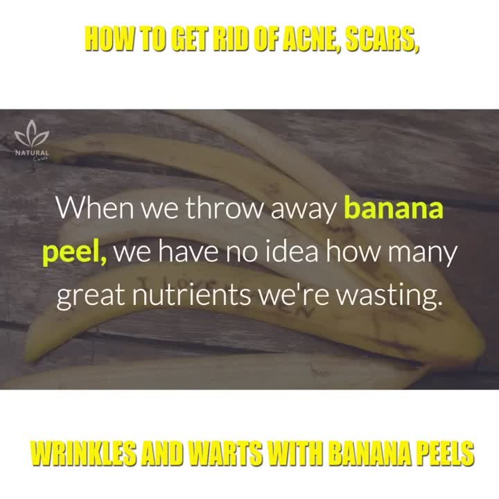 How to Get Rid of Acne, Scars, Wrinkles and Warts with Banana Peels