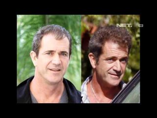 Entertainment News - Selebriti yang tanam rambut