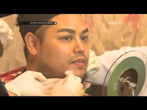 Ivan Gunawan Jalani Treatment Vampire