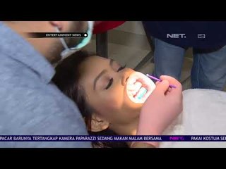 Demi Senyum Sempurna di Ajang Miss Universe, Bunga Jelitha Lakukan Veneer Gigi