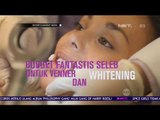 Tren Pemutihan Gigi, Ini Bedanya Veneer dengan Whitening Gigi Biasa