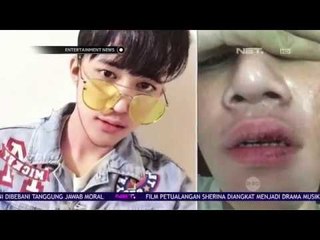 Dicky 'Smash' Dikeroyok Orang Tak Dikenal