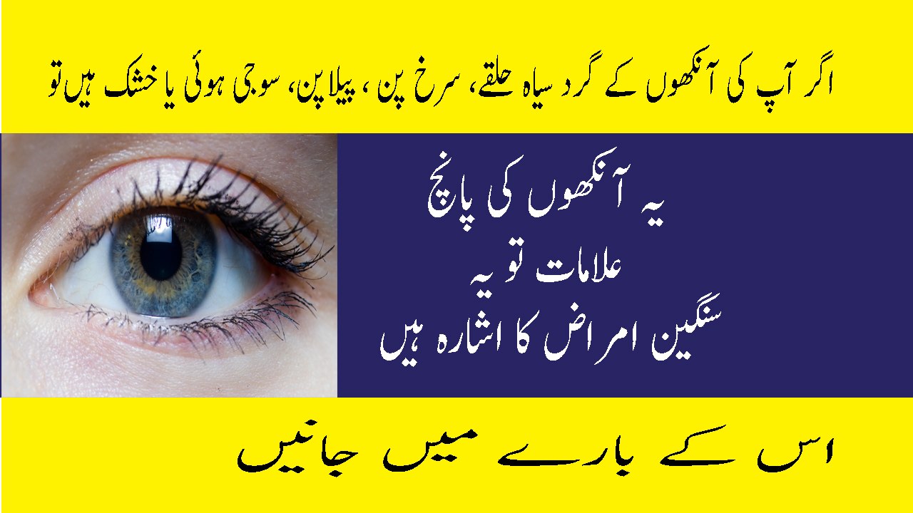 Eyes Care Tips in Urdu Eyes Diseases In Urdu Aankhon Ki Ye 5 Alamat Sangeen Amraz Ka Bais Ban Sakti Hain