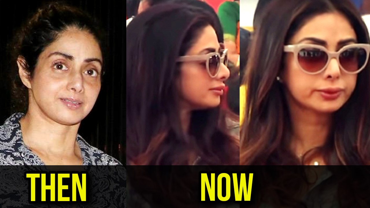 SHOCKING Sridevi SURGERY GONE WRONG | Celebrity Transformation