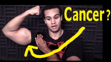 Did Vegan Gains diet give him Cancer?