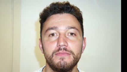 Op Dr Mustafa Ali Yanık Burun Da Şekil Bozukluğu Şikayet İ İle Gelen Hasta Sonuçlarını Paylaşıyor.