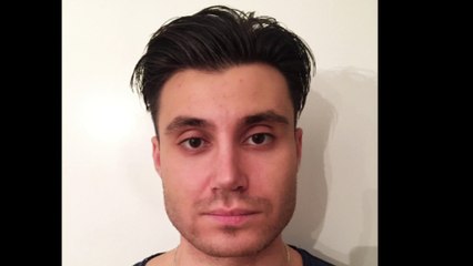 Mustafa Ali Yanık burunda şekil bozukluğu şikayet ile başvuran hastalarının sonuçlarını paylaşıyor