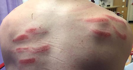 Sırtına Tekme Gelen Kaleci Hastanelik Oldu