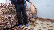 Ölen Eşinin Protez Bacağını Bağışlayacak İhtiyaç Sahibi Arıyor