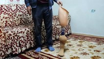 Ölen eşinin protez bacağını bağışlayacak ihtiyaç sahibi arıyor