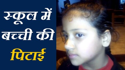 टीचर ने स्कूल में बच्ची को मारे थप्पड़, थाने में मामला दर्ज