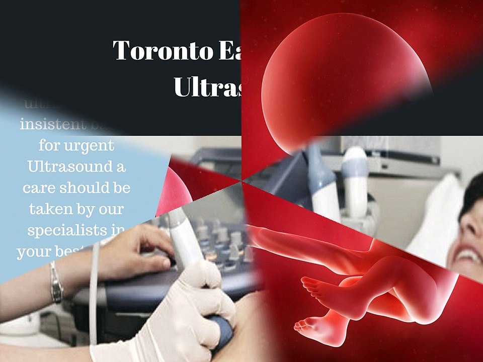 Ultrasound Clinics In Pickering and Canada