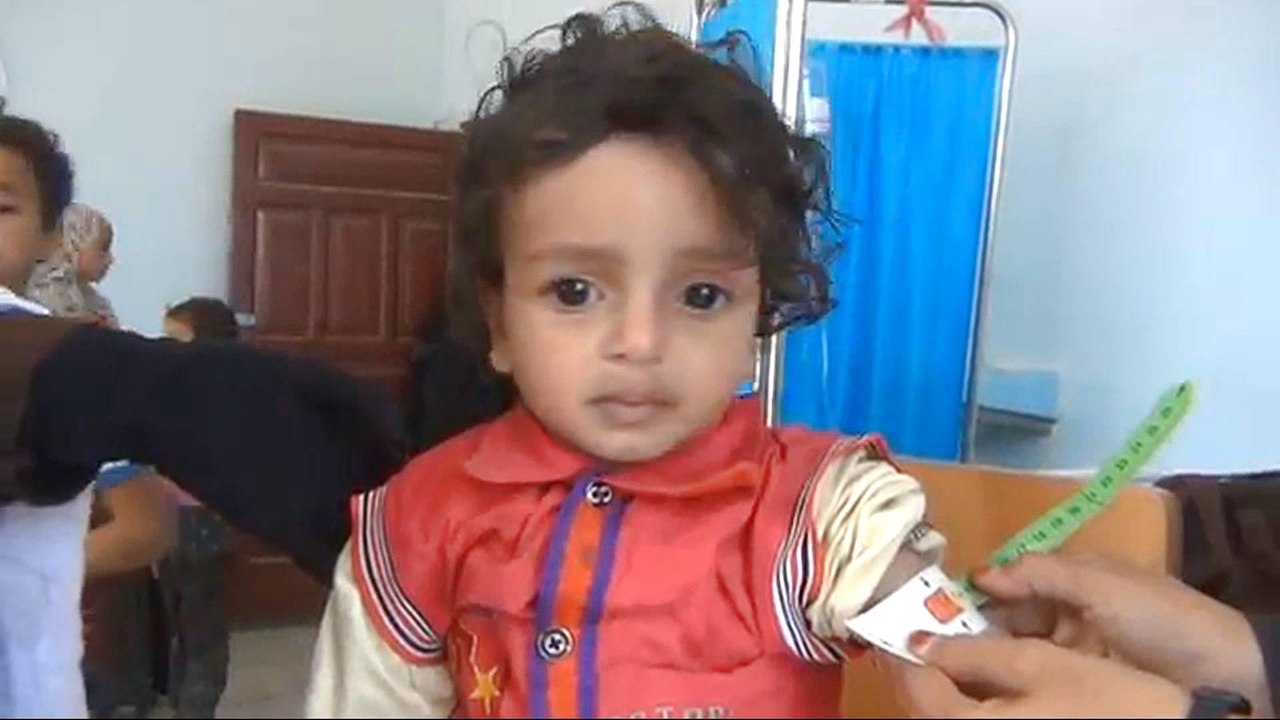 Yemen's children pay the price of war