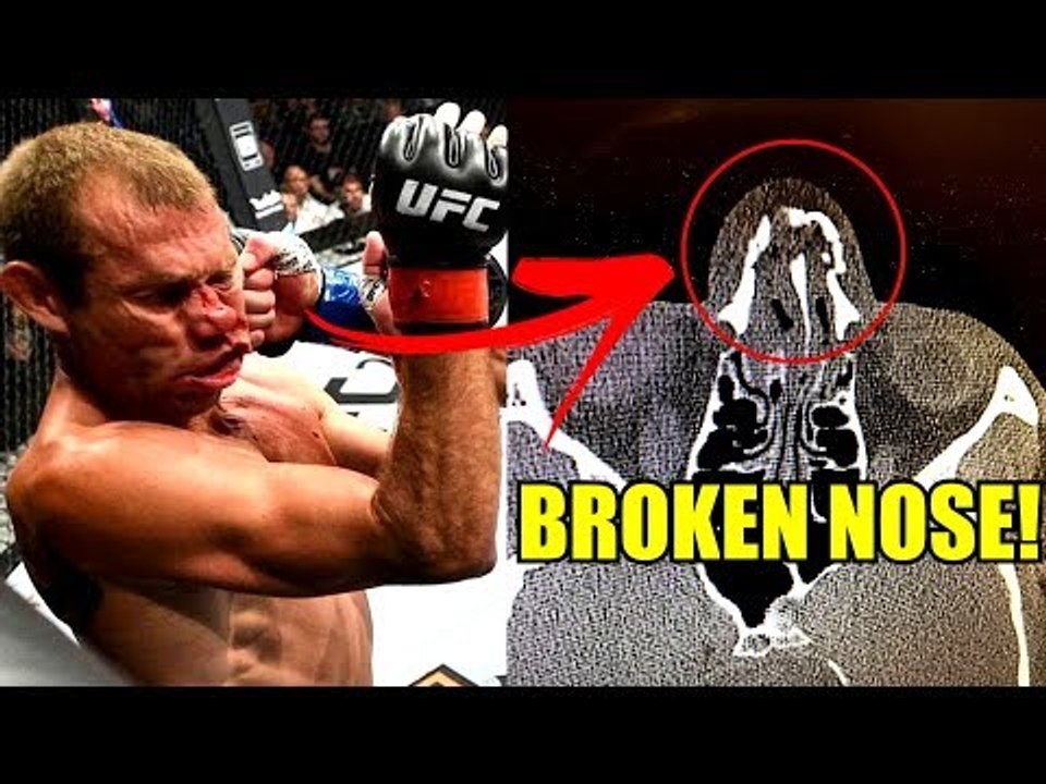 MMA Community reacts to Donald Cerrone vs Darren Till,Artem and Conor McGregor backstage,FN118 RES