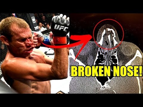 MMA Community reacts to Donald Cerrone vs Darren Till,Artem and Conor McGregor backstage,FN118 RES