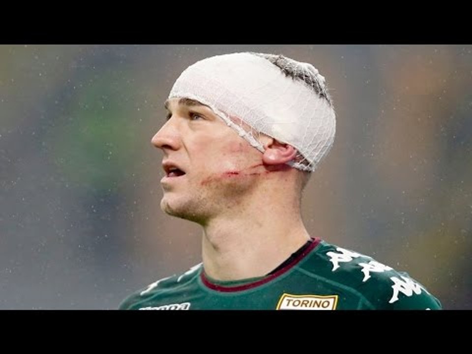 Top 10 Horrific Injuries In Football 2017 •  OUCH!