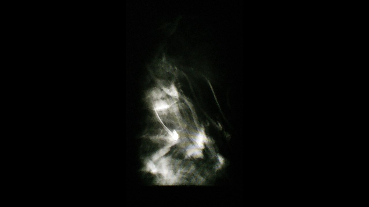 Living Hand