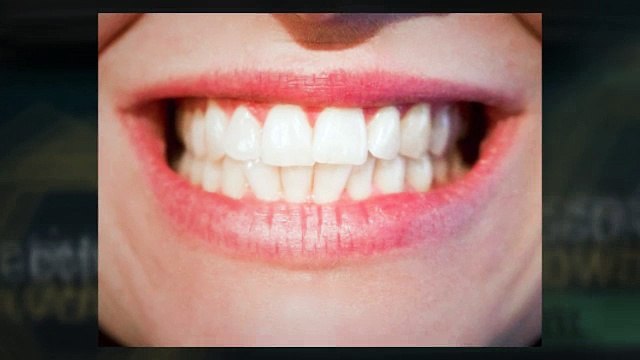 Activated Charcoal Toothpaste