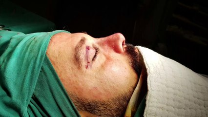 Mustafa Ali Yanık burunda şekil bozukluğu şikayet ile başvuran hastaları ve sonuçlarını paylaşıyor