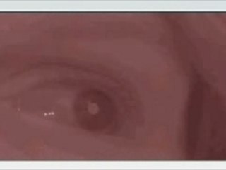 Suivi du Regard - Eye Tracking