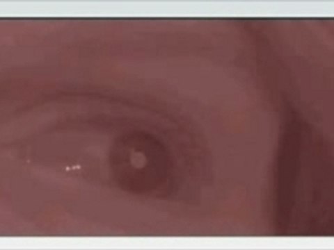 Suivi du Regard - Eye Tracking