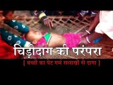 Children who play the tradition of stained stomach hot  bars in jharkhand II चिड़ीदाग की परंपरा