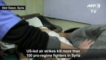 Pro-Syrian regime fighters treated at a Deir Ezzor hospital