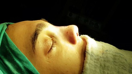 Op Dr Mustafa Ali Yanık Başarılı bir burun estetiğinin önemini anlatıyor. Mustafa Ali Yanık burun şikayet ve çözümleri