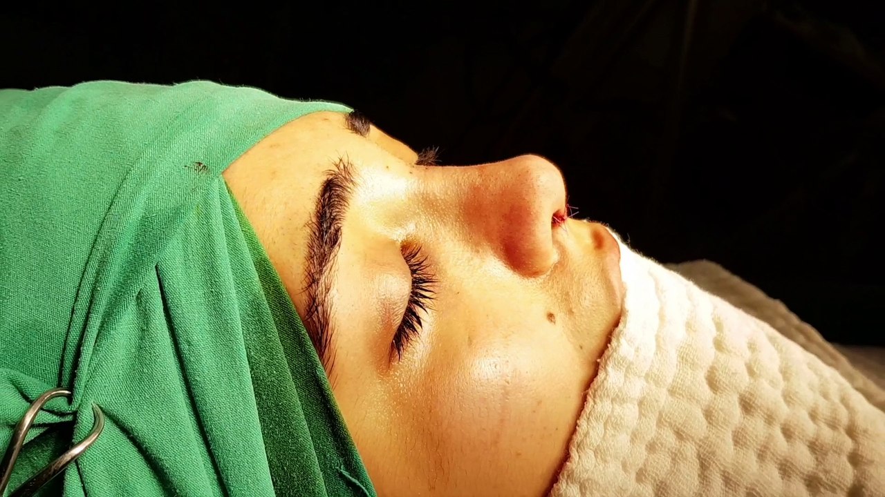 Op Dr Mustafa Ali Yanık Başarılı bir burun estetiğinin önemini anlatıyor. Mustafa Ali Yanık burun şikayet ve çözümleri