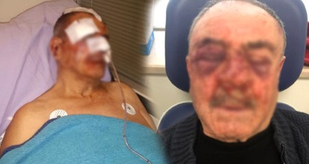 İzmir'de Komşusundan 1,5 Yıllık Aidatı İsteyen Yaşlı Adam, Hastanelik Oldu