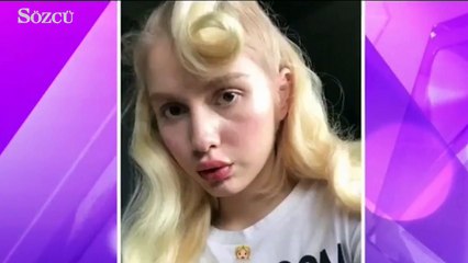 Aleyna Tilki’nin silikon talebine ret