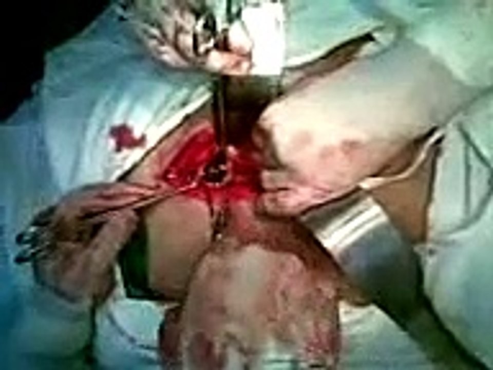 amazing surgery