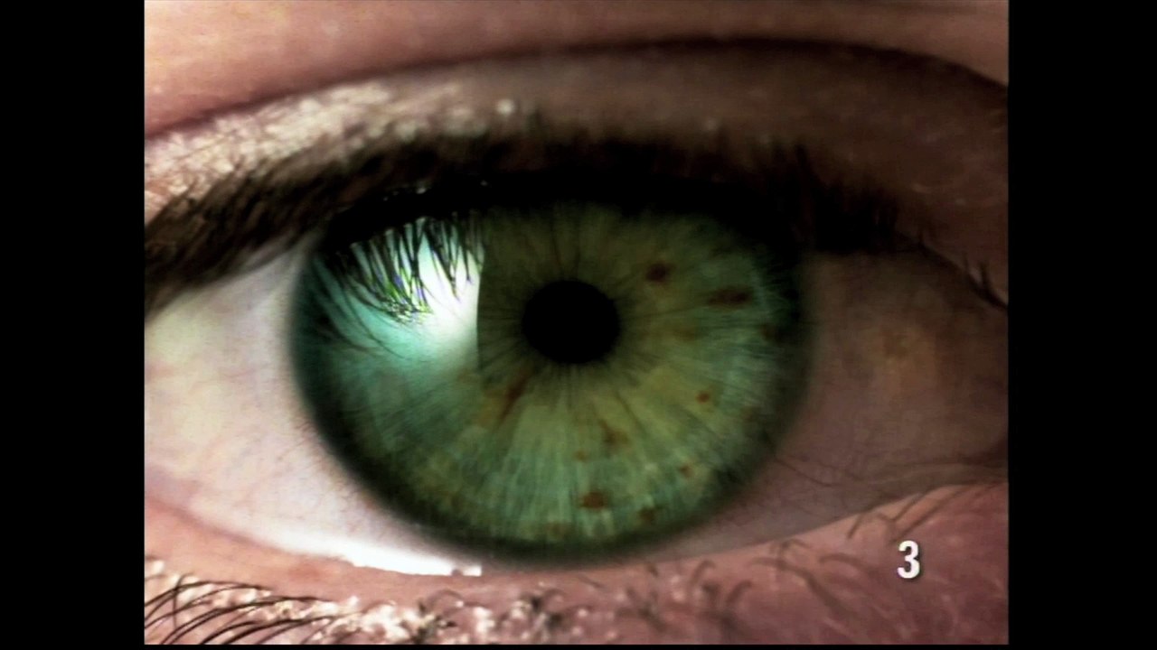Oeil